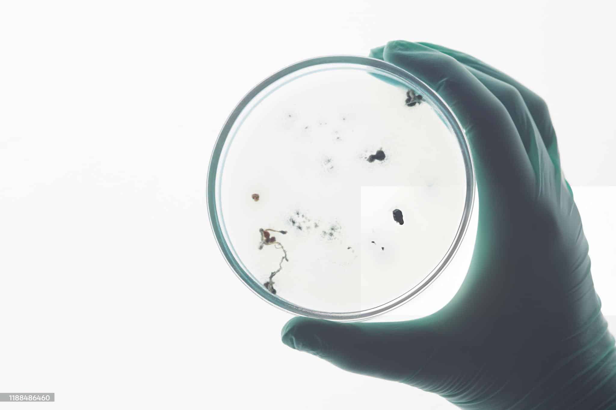 Amazing Can Urgent Care Test For Mold Exposure Wallpaper for Desktop Amazing Can Urgent Care Test For Mold Exposure Wallpaper for Desktop