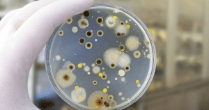Mold sample collected by a TDLR-licensed Houston inspector for lab identification